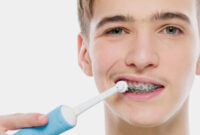 Brushing-Your-Teeth-With-Braces-01