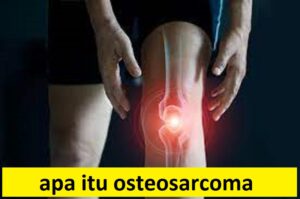 apa itu osteosarcoma