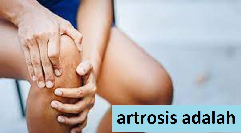 artrosis adalah